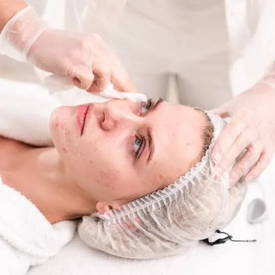Acne Clearing Facial